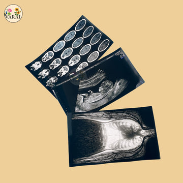Baby Scan Cutouts - Set Of 3